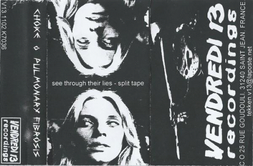 Pulmonary Fibrosis : See Through Their Lies